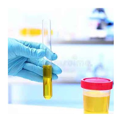 TH1/Th2 balance urine tests