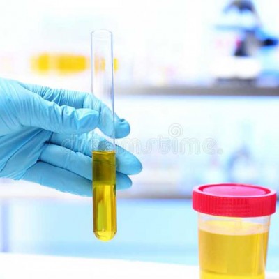 TH1/Th2 balance urine tests